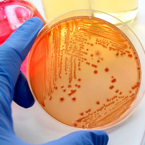 Solving bacteria problems in well water bacteria